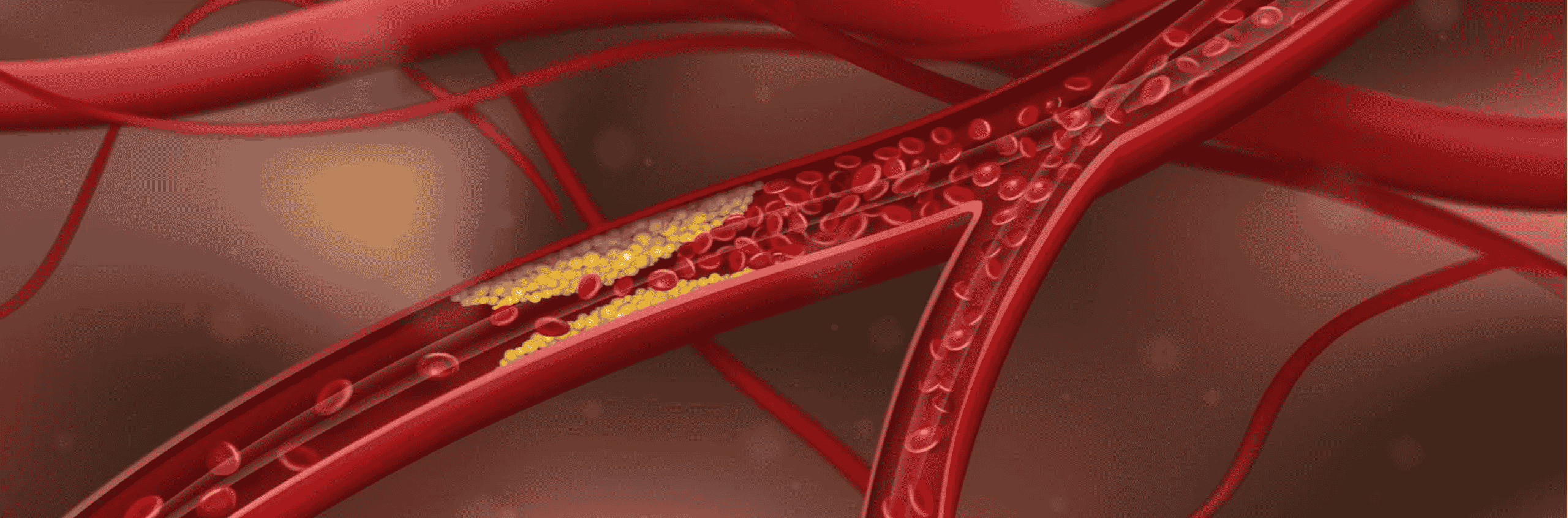 Going Beyond ‘Cholesterol’