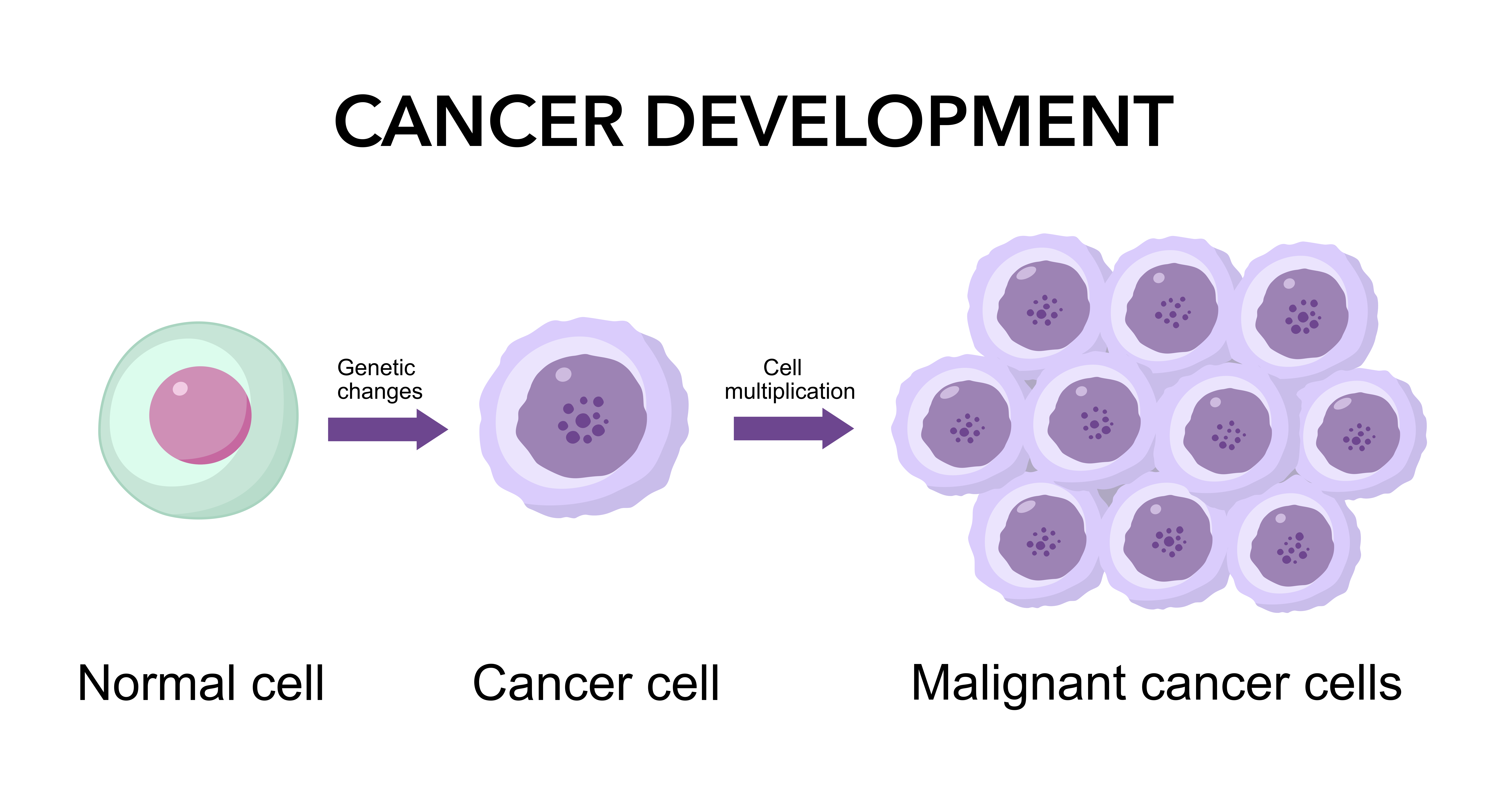 how bowel cancer develops